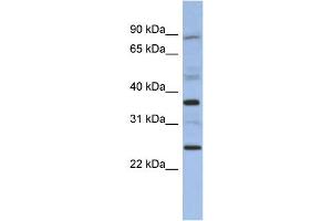 WB Suggested Anti-MAGEB3 Antibody Titration: 0.