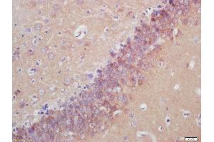 Formalin-fixed and paraffin embedded rat brain labeled with Anti-SPRN Polyclonal Antibody, Unconjugated  at 1:200 followed by conjugation to the secondary antibody and DAB staining (SPRN antibody  (AA 100-147))