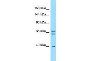 Western Blotting (WB) image for anti-Piccolo (Presynaptic Cytomatrix Protein) (PCLO) (C-Term) antibody (ABIN2789740) (PCLO antibody  (C-Term))