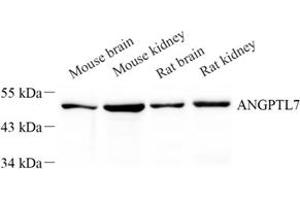 Western blot analysis of Angptl7 (ABIN7073049) at dilution of 1: 500 (ANGPTL7 antibody)