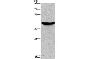 Western blot analysis of Human fetal liver tissue, using GALK1 Polyclonal Antibody at dilution of 1:450 (GALK1 antibody)