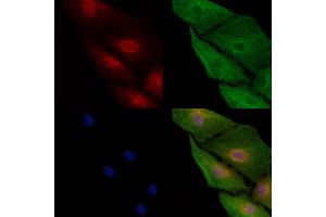ABIN6260960 and ABIN6272912 staining  cells by IF/ICC. (COMMD1 antibody  (Internal Region))