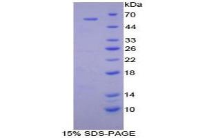 SDS-PAGE analysis of Human Cathepsin A Protein. (CTSA Protein)