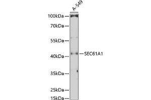 Western blot analysis of extracts of A-549 cells, using SEC61 Antibody (1614) at 1:3000 dilution.