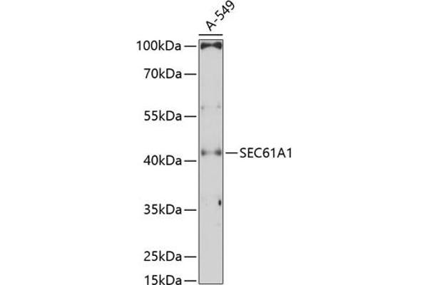 SEC61A1 Antikörper  (AA 310-420)