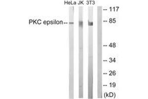 Western blot analysis of extracts from HeLa/Jurkat/3T3 cells, treated with PMA 125ng/ml 30', using PKC epsilon (Ab-729) Antibody. (PKC epsilon antibody  (AA 688-737))