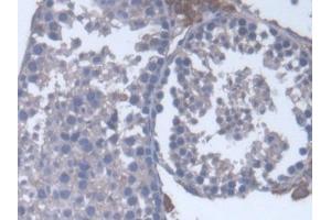 #VALUE! (CYP17A1 antibody  (AA 201-507))