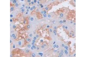 IHC-P analysis of Kidney tissue, with DAB staining. (CMTM1 antibody  (AA 1-286))