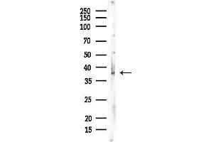 anti-ELOVL Fatty Acid Elongase 6 (ELOVL6) (N-Term) antibody
