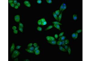 Immunofluorescent analysis of PC-3 cells using ABIN7150725 at dilution of 1:100 and Alexa Fluor 488-congugated AffiniPure Goat Anti-Rabbit IgG(H+L) (MAP2K7 antibody  (AA 17-160))