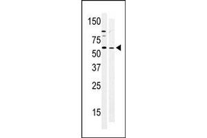 Western Blotting (WB) image for anti-PTK6 Protein tyrosine Kinase 6 (PTK6) (N-Term) antibody (ABIN359990) (PTK6 antibody  (N-Term))