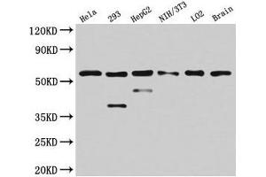 Western Blot Positive WB detected in: Hela whole cell lysate, 293 whole cell lysate, HepG2 whole cell lysate, NIH/3T3 whole cell lysate, LO2 whole cell lysate, Mouse brain tissue All lanes: PKM antibody at 4. (PKM antibody  (AA 185-461))