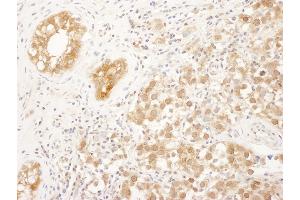 Immunohistochemistry (IHC) image for anti-Farnesyltransferase, CAAX Box, alpha (FNTA) (AA 329-379) antibody (ABIN7455017)