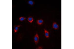 Immunofluorescent analysis of CD157 staining in Raw264. (BST1 antibody  (Center))