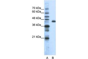 Western Blotting (WB) image for anti-Zinc Finger Protein 36, C3H Type-Like 2 (ZFP36L2) antibody (ABIN2461803)