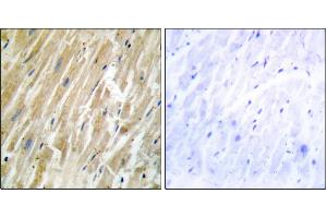 Immunohistochemistry analysis of paraffin-embedded human heart tissue using CALR antibody. (Calreticulin antibody)