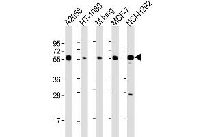 Western Blot at 1:2000 dilution Lane 1: A2058 whole cell lysate Lane 2: HT-1080 whole cell lysate Lane 3: mouse lung lysate Lane 4: MCF-7 whole cell lysate Lane 5: NCI-H292 whole cell lysate Lysates/proteins at 20 ug per lane. (MMP14 antibody  (N-Term))