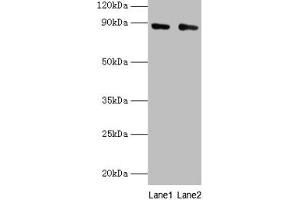 Western blot All lanes: CFB antibody at 2 μg/mL Lane 1: K562 whole cell lysate Lane 2: HepG2 whole cell lysate Secondary Goat polyclonal to rabbit IgG at 1/10000 dilution Predicted band size: 86, 69 kDa Observed band size: 86 kDa (Complement Factor B antibody  (AA 26-751))