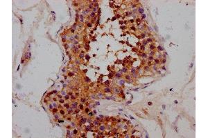 IHC image of ABIN7168374 diluted at 1:300 and staining in paraffin-embedded human testis tissue performed on a Leica BondTM system. (MEX3B antibody  (AA 253-375))