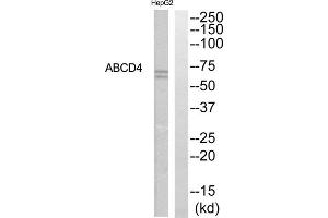 Western blot analysis of extracts from HepG2 cells, using ABCD4 antibody. (ABCD4 antibody  (Internal Region))