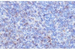 Immunohistochemistry of paraffin-embedded Mouse spleen using NOTCH3 Polyclonal Antibody at dilution of 1:100 (40x lens).