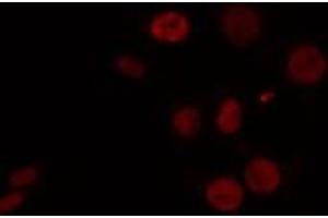 ABIN6274460 staining HeLa cells by IF/ICC. (CELF1 antibody  (N-Term))