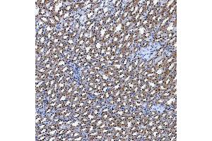 IHC analysis of SF3A3 using anti-SF3A3 antibody (ABIN7599863).