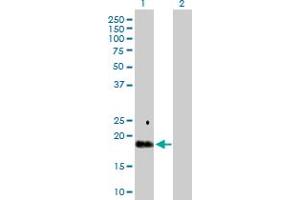 Western Blot analysis of TGFA expression in transfected 293T cell line by TGFA MaxPab polyclonal antibody. (TGFA antibody  (AA 1-160))
