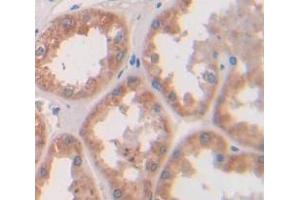 Used in DAB staining on fromalin fixed paraffin- embedded kidney tissue (Parkin antibody  (AA 229-465))