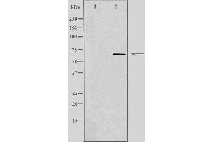 Western blot analysis of extracts from COLO205 cells, using IGFALS antibody.