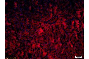 Formalin-fixed and paraffin embedded rat liver labeled with Anti-P450 1A2/CYP1A2 Polyclonal Antibody, Unconjugated (ABIN742470) followed by conjugation to the secondary antibody and DAPI staining (CYP1A2 antibody  (AA 221-320))