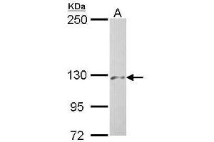 WB Image Sample (30 ug of whole cell lysate) A: Hep G2 , 5% SDS PAGE antibody diluted at 1:500 (PHKA2 antibody  (C-Term))