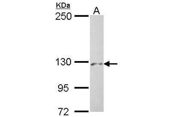 PHKA2 抗体  (C-Term)