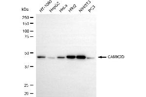 Western blotting analysis using CAMK2D antibody (ABIN7797835).