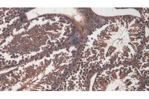 Detection of CD99 in Mouse Testis Tissue using Polyclonal Antibody to Cluster Of Differentiation 99 (CD99) (CD99 antibody  (AA 27-161))
