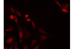 ABIN6267703 staining Hela by IF/ICC. (PRKAB1 antibody  (pSer181))