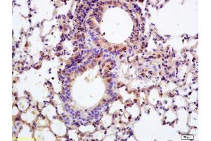 Formalin-fixed and paraffin embedded rat lung labeled with Anti-APPD/LAPF Polyclonal Antibody, Unconjugated (ABIN872648) at 1:200 followed by conjugation to the secondary antibody and DAB staining (PLEKHF1 antibody  (AA 75-124))