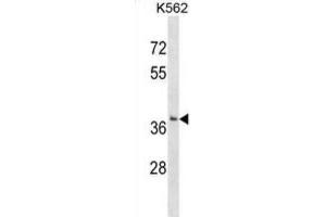 Western Blotting (WB) image for anti-Single-Strand-Selective Monofunctional Uracil-DNA Glycosylase 1 (SMUG1) antibody (ABIN2999446)