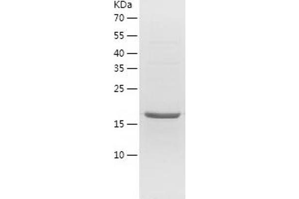 HPGDS Protein (AA 2-199) (His tag)