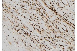 ABIN6267343 at 1/100 staining Human kidney tissue by IHC-P. (Vimentin antibody  (pSer56))