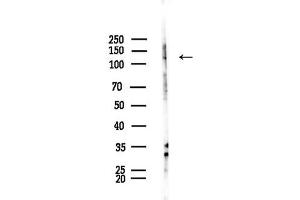 anti-ADAM Metallopeptidase with Thrombospondin Type 1 Motif, 10 (ADAMTS10) (C-Term) antibody