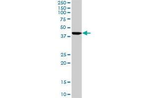 ISL1 MaxPab rabbit polyclonal antibody. (ISL1 antibody  (AA 1-346))