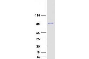 Validation with Western Blot (MBTD1 Protein (Myc-DYKDDDDK Tag))