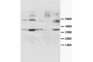 Western Blotting (WB) image for anti-Cyclin D1 (CCND1) antibody (ABIN1106872) (Cyclin D1 antibody)