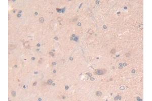 DAB staining on IHC-P; Samples: Rat Spinal cord Tissue (LAMB2 antibody  (AA 75-223))
