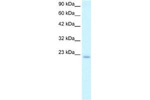 WB Suggested Anti-POLE3 Antibody Titration:  2. (POLE3 antibody  (N-Term))