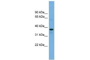 WB Suggested Anti-VPS16 Antibody Titration: 0.