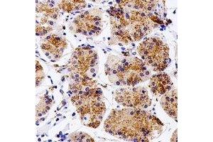 Immunohistochemical analysis of Kua staining in human stomach formalin fixed paraffin embedded tissue section.