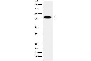 Western Blotting (WB) image for anti-Minichromosome Maintenance Complex Component 7 (MCM7) antibody (ABIN7607036)