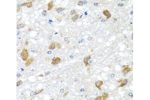 Immunohistochemistry of paraffin-embedded Rat brain using PIP4K2B Polyclonal Antibody at dilution of 1:100 (40x lens). (PIP4K2B antibody)